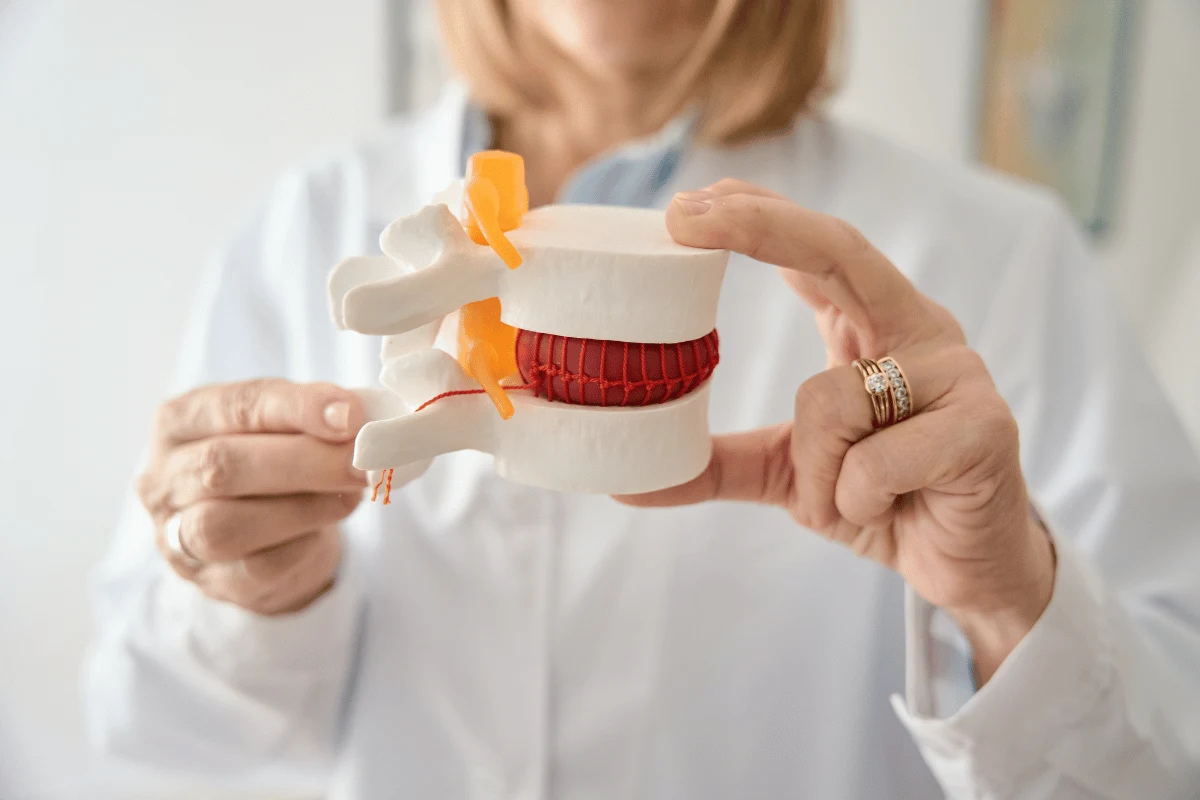 Tratamientos para hernia discal